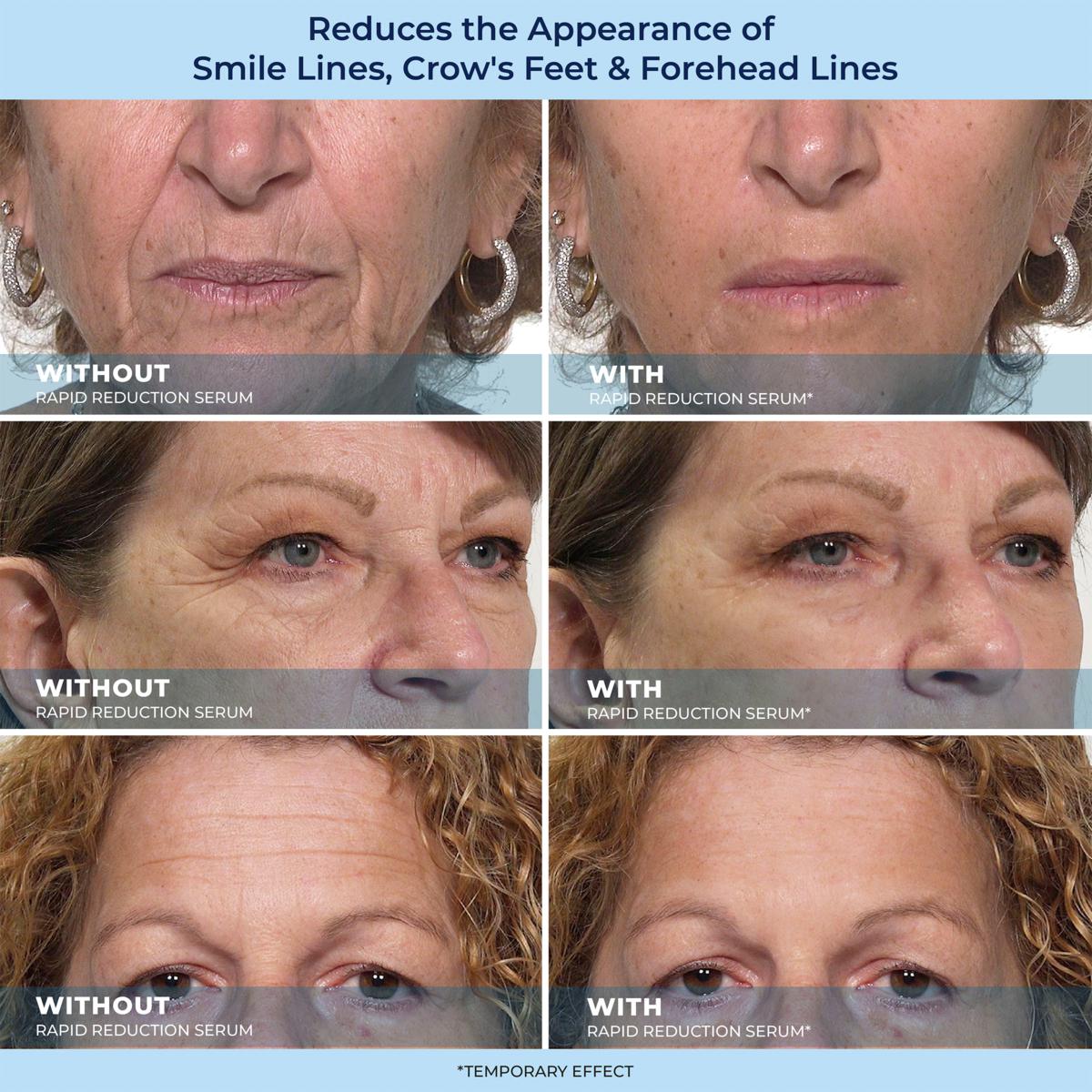 🔥Letzter Tagesverkauf: 49 % Rabatt auf LBMLBM-HOYGI™ 60-Sekunden-Anti-Aging-Serum gegen Falten, Tränensäcke und Augenringe